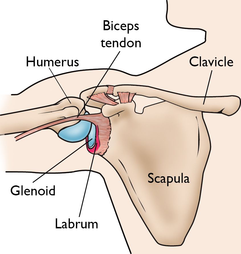 Labral tear Seaside Surgery Center